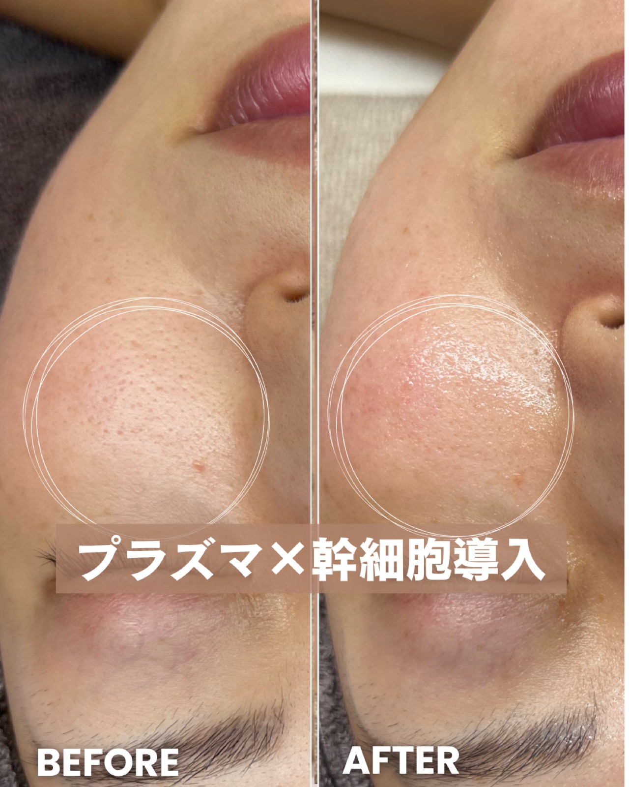 フェイシャル Before/After
